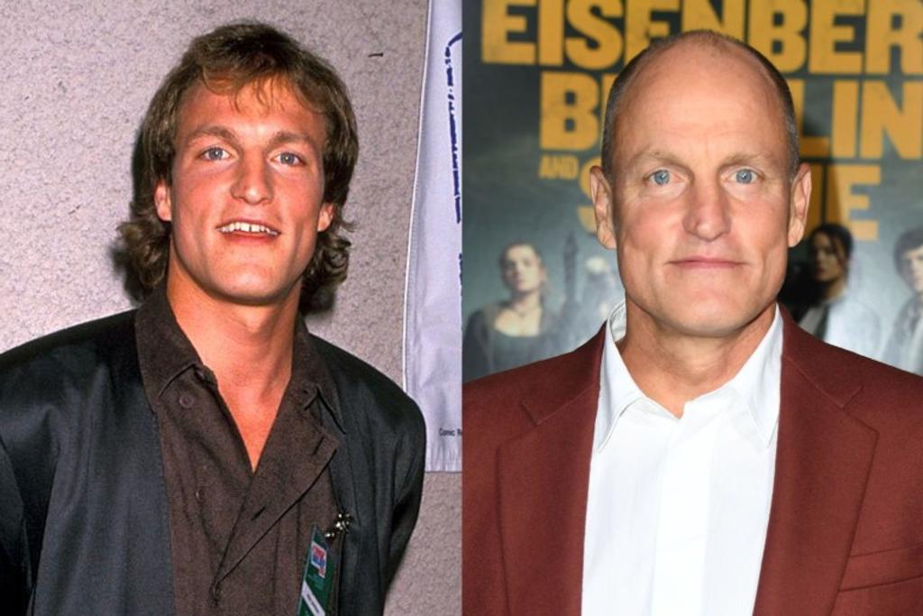 Woody Harrelson Young Hair